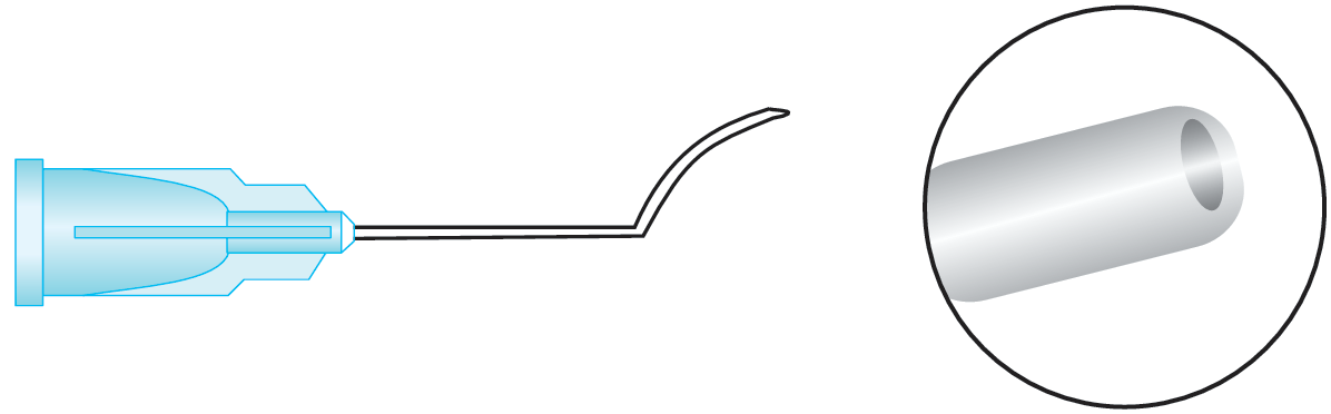Lasik Irrigating Cannula